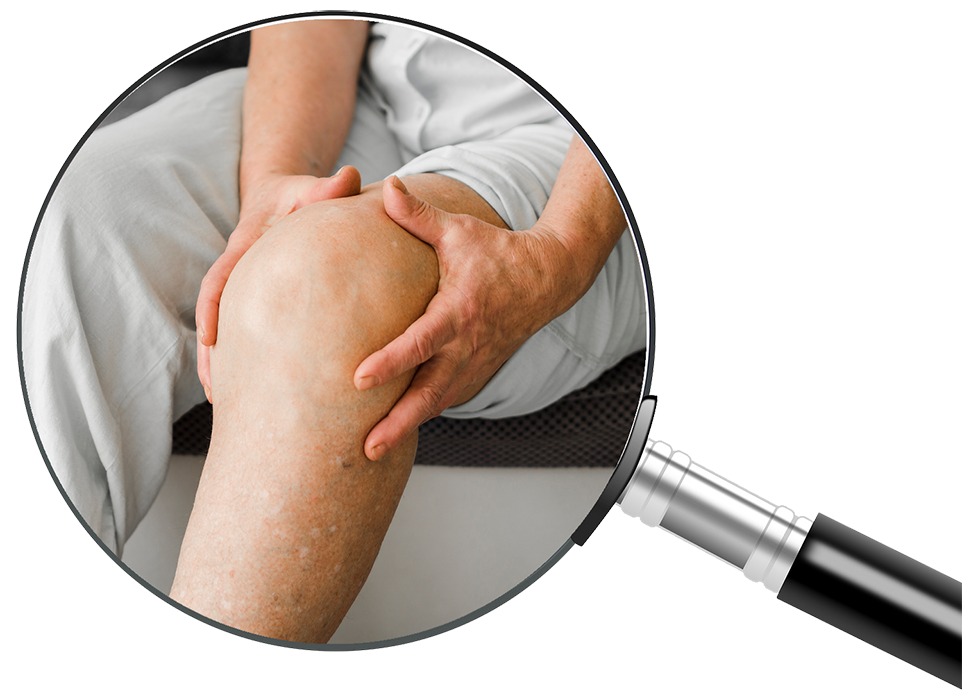 Rodilla_TNDR_Causas_Bilbao Rodilla_TNDR_Causas_Bilbao